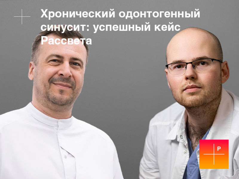 Хронический одонтогенный синусит: успешный кейс Рассвета